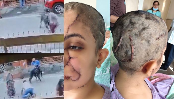 CCTV footage shows pet dog attacking woman during morning walk in Bengaluru