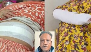 Two women injured in Bhopal sword attack over stray dogs