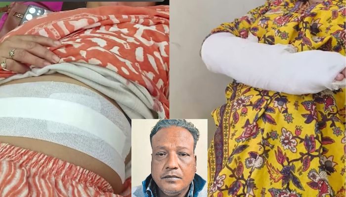 Two women injured in Bhopal sword attack over stray dogs