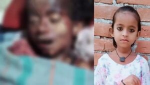 Blood-soaked body of 8-year-old found in field after stray dog attack